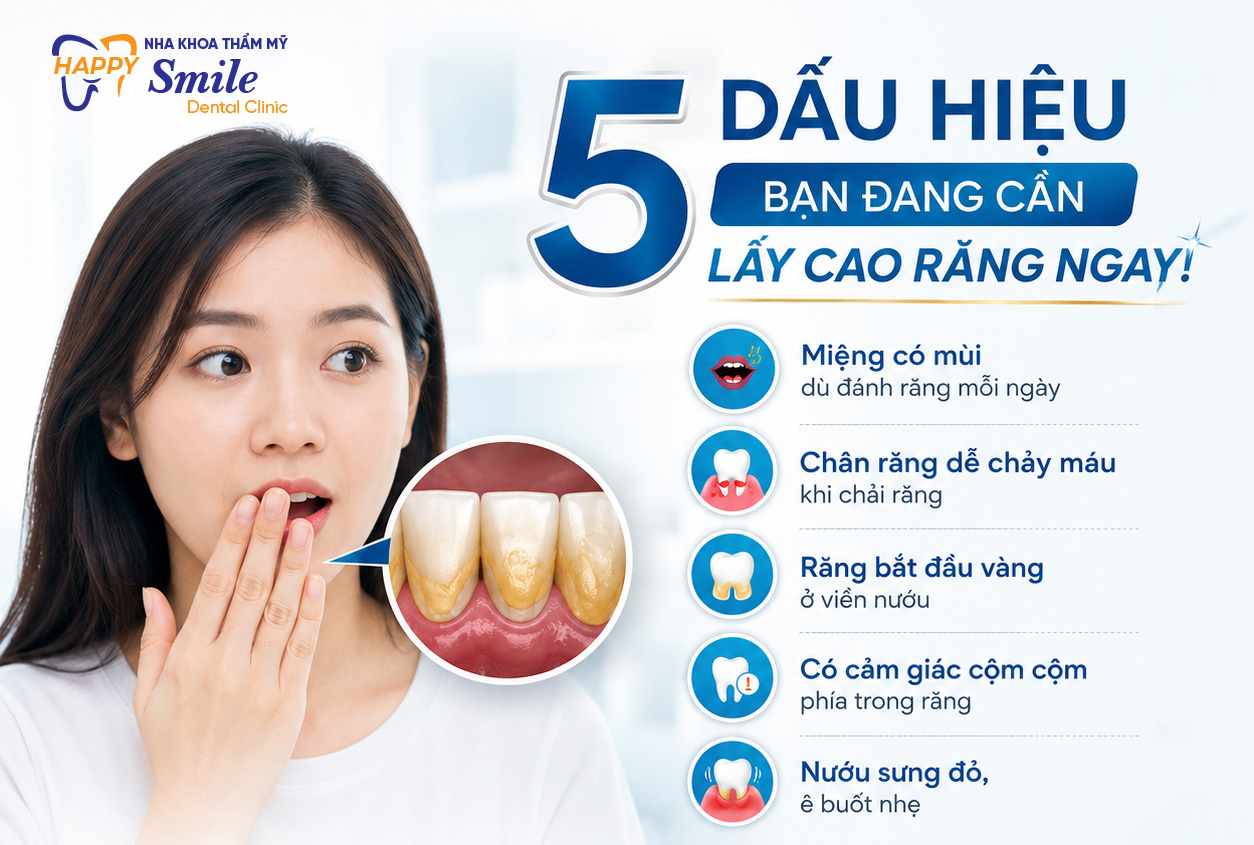 5 Dấu Hiệu Bạn Đang Cần Lấy Cao Răng Ngay