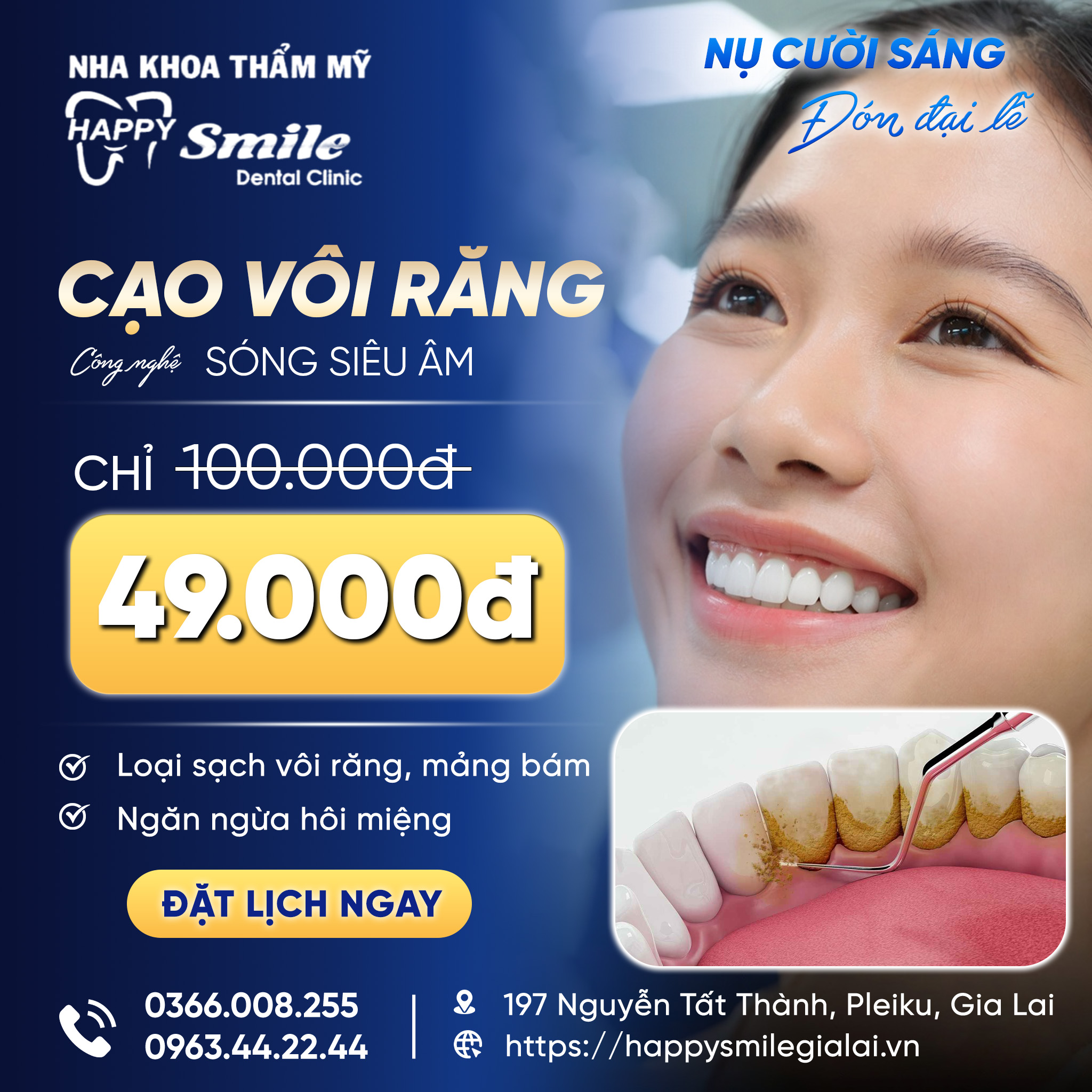 Ưu đ&atilde;i cạo v&ocirc;i răng sạch s&acirc;u chỉ 49k tại Nha khoa thẩm mỹ Happy Smile Gia Lai.